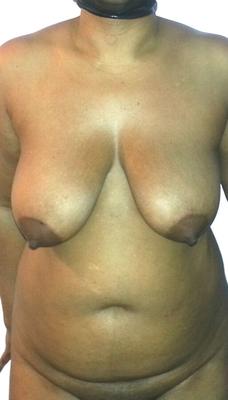 GORDURA LATINA TETAS