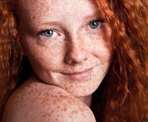 Filles avec des taches de rousseur