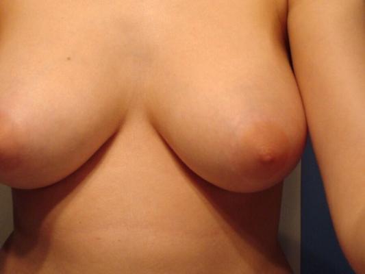 Jeune ado aux gros seins naturels - Nanette