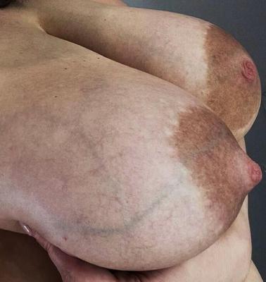 AREOLAS WITH TEXTURE