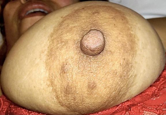 ¿Puedes chuparle las tetas?